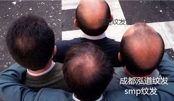 纹发案例效果图10