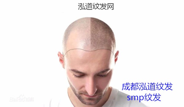 纹发案例效果图8