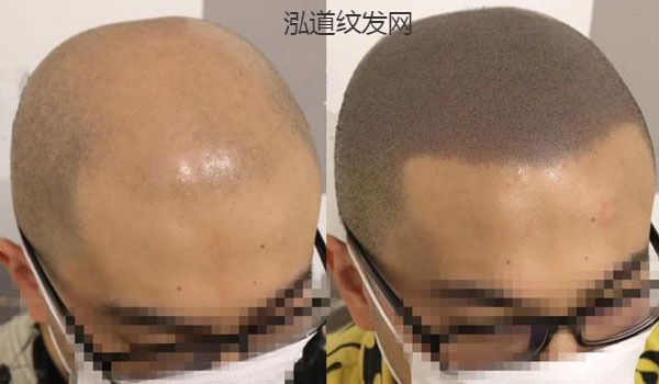 纹发案例效果图9