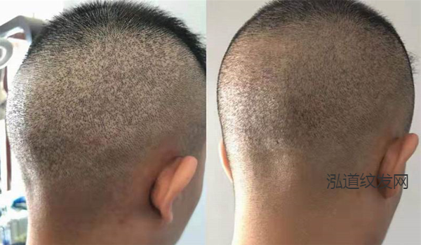 纹发案例效果图7