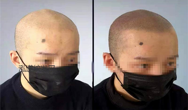 纹发案例效果图5