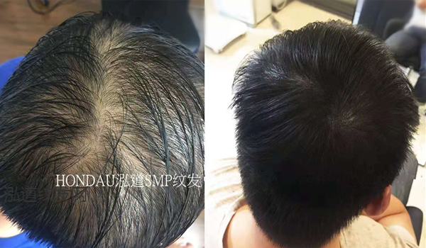 纹发案例效果图3