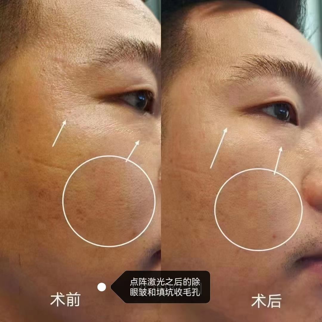 mmexport1682561122817