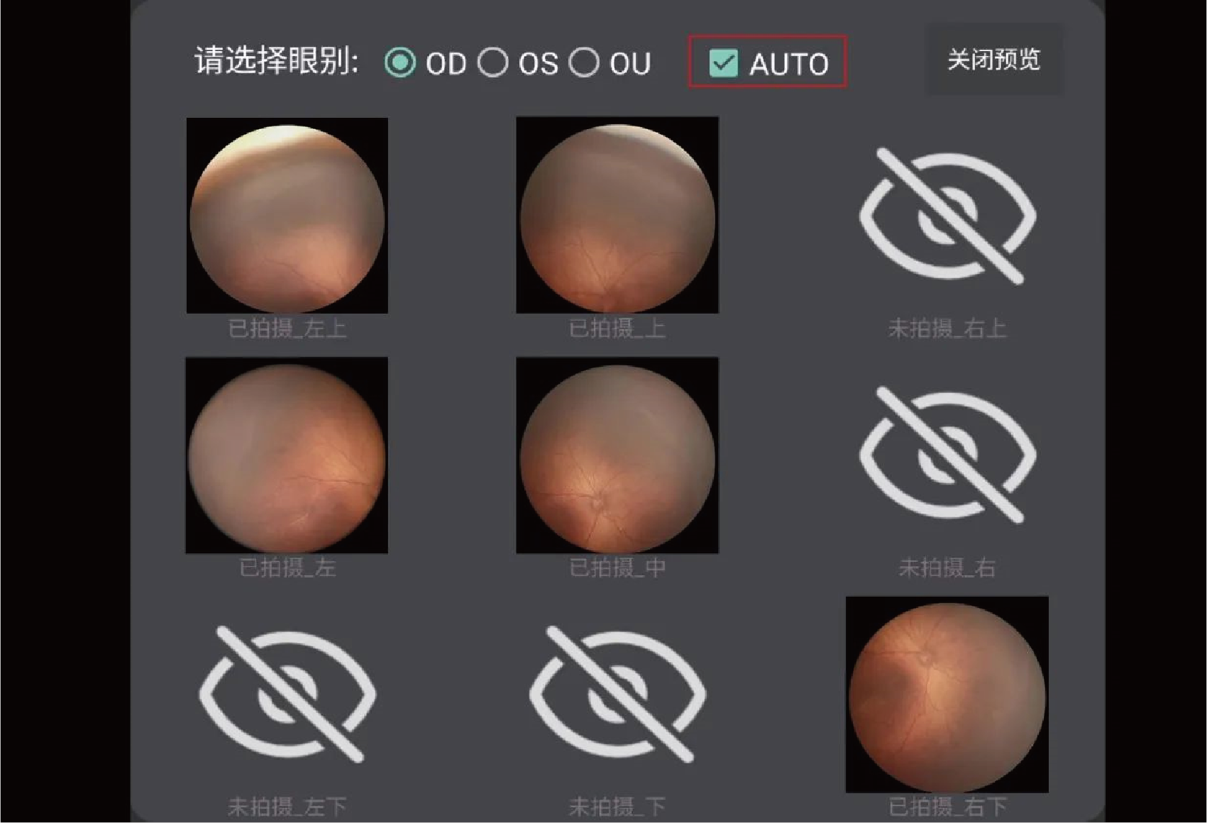 描述