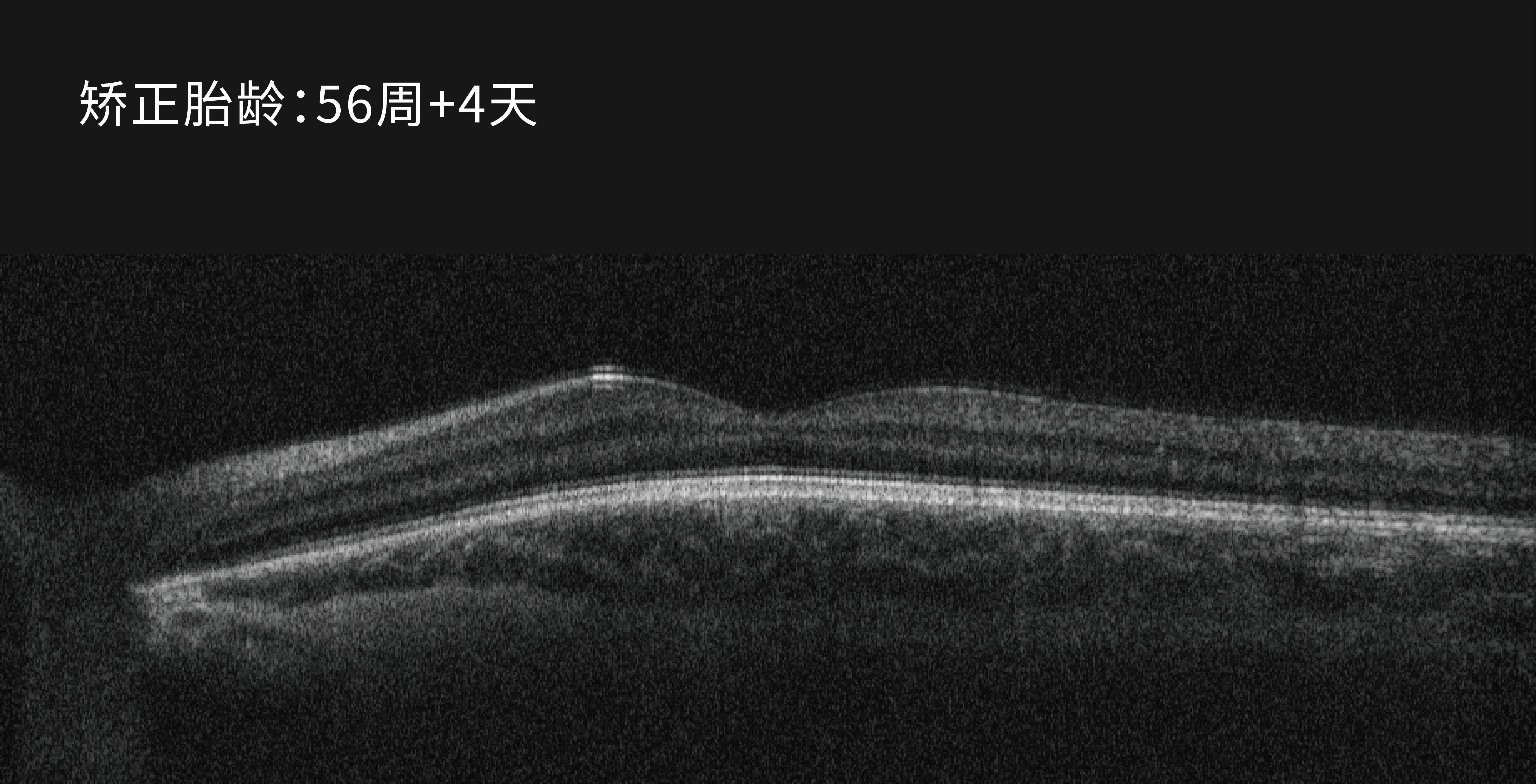 描述