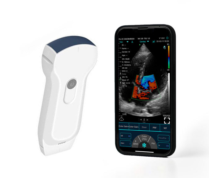 Multipurpose Ultrasound Probes