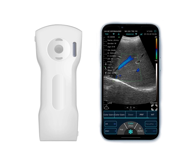 Multipurpose Ultrasound Probes Pro