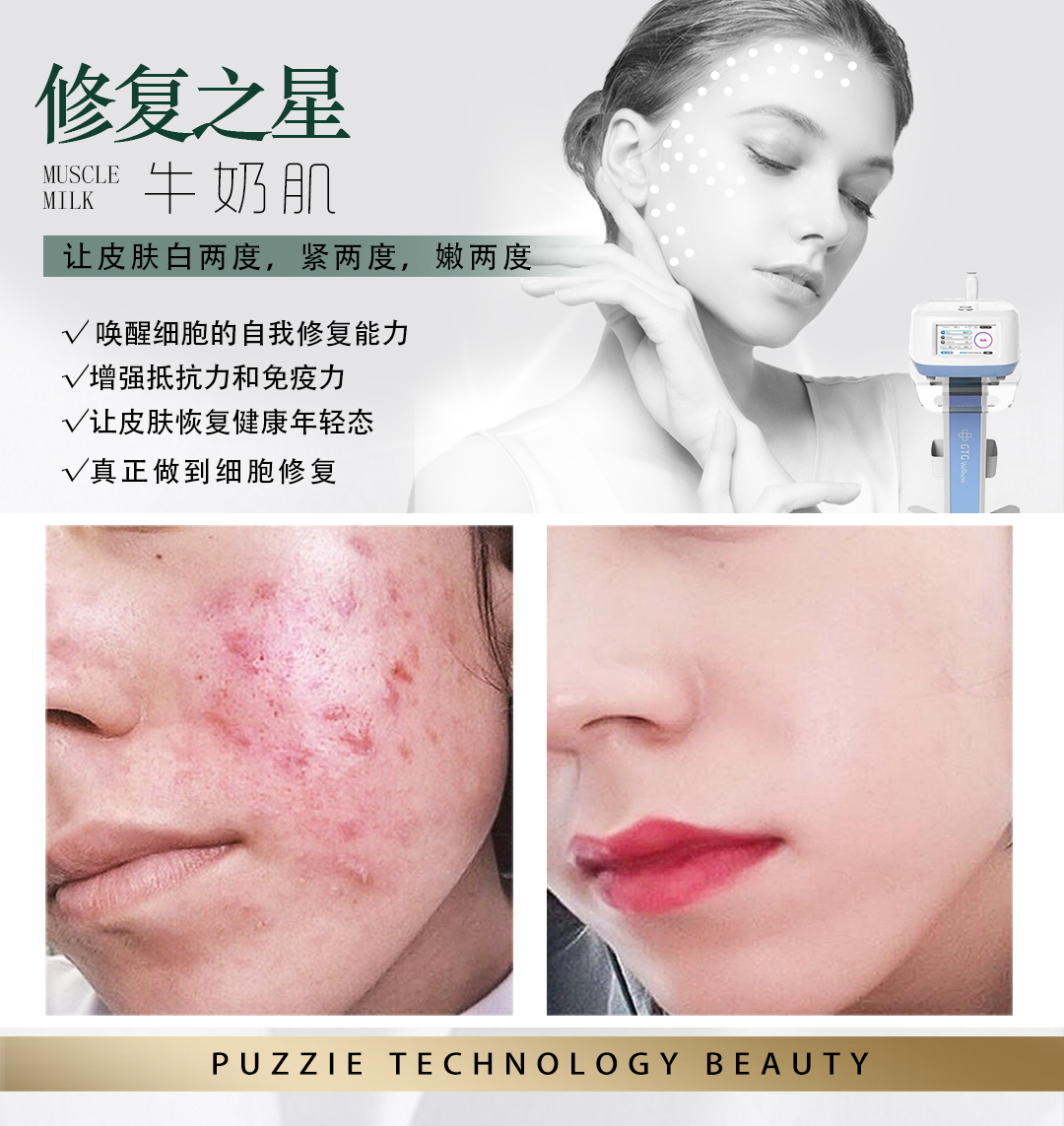 ABAS修复之星牛奶肌