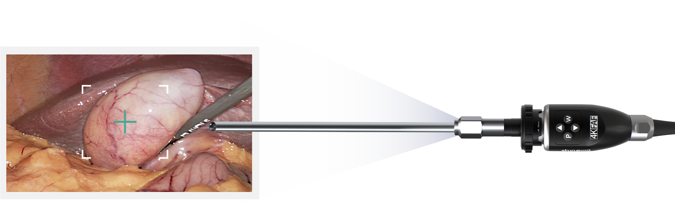 描述