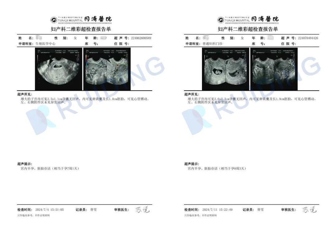 【瑞丁GFC生殖医院喜报】38岁刘小姐三次试管终迎“好孕”曙光