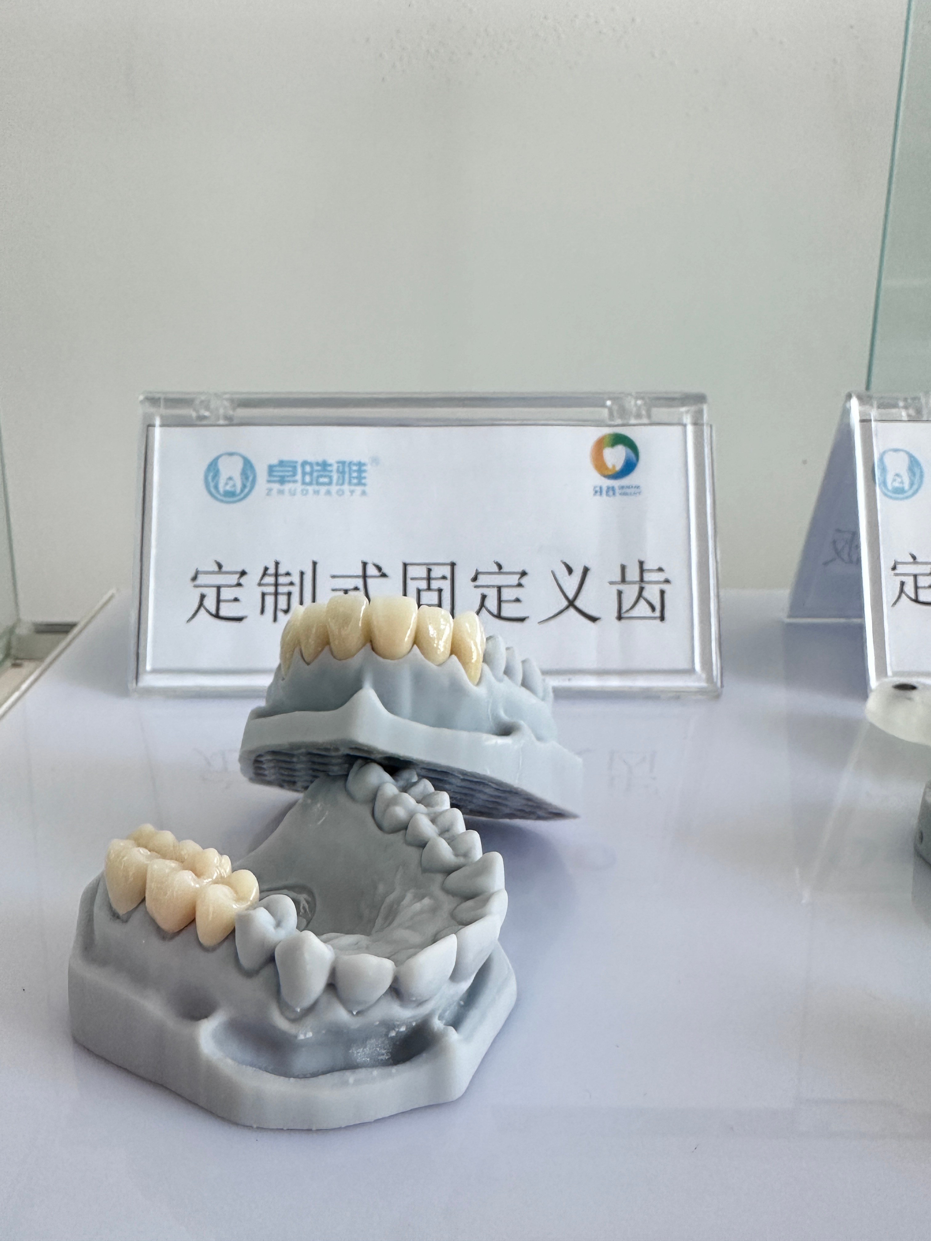 定制式固定义齿